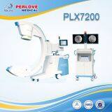 C-arm Machines PLX7200 for Bone Fixing Surgery