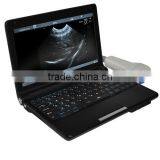 Laptop 10.1 Inch LCD pc Ultrasound Machine for Scan With 3D Function thumbnail-2