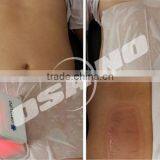 New Portable Slimming Machine Cryotherapy for Weight Loss thumbnail-5