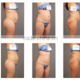 Hips Shaping Body Shaping HIFU Machine/Powerful Improve Blood Circulation Multi-polar RF Ultrashape Slimming Machine For Salon 220 / 110V thumbnail-6