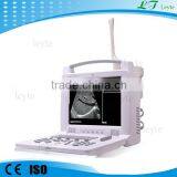 LT3018I CE Medical Digital Laptop Scanner Ultrasound Machine for Sale