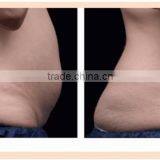 Chest Shaping Cheap Hifu Liposonix Hifu Ultrasound Body Shaping Body Slimming Machine Nasolabial Folds Removal thumbnail-3