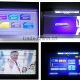 Pimples Treatment NEW Ipl Rf Shr Ipl Hair Removal Machine Painless Permanent Hair Removal Ipl Hair Removal Opt Acne Scars Treatment thumbnail-6