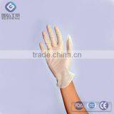 Food Prepared Food Service Vinyl Gloves thumbnail-1