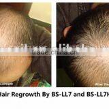 2014 New Arrival Laser Machine for Hair Loss thumbnail-6