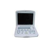 Portable Convex Ultrasound Scanner---CE Certified