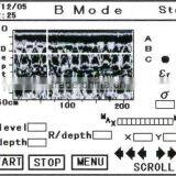 Portable and Easy to Operate Ground Penetrating Rader Device Senci-on Pro for Industrial Use , Small Lot Order Available thumbnail-4