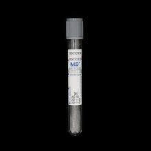 Glucose Blood Collection Tube Disposable Vacuum Plasma Blood Collection Tube for Blood Glucose Determination thumbnail-2
