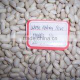 2014 Chinese White Kidney Bean With Cheap Price thumbnail-6