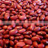 High Quality Red Bean From Viet Nam With Best Price thumbnail-1