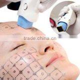 Hot Sale Skin Rejuvenation Skin Tightening rf High Frequency Wrinkle Removal Machine thumbnail-4