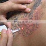 Q Switched Laser Machine Laser Tattoo Removal Machine Nd Yag Permanent Tattoo Removal Decive For Sale Tattoo Removal Laser Equipment thumbnail-1