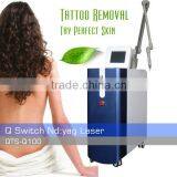 1500mj Hot Sale Q Switched 0.5HZ Laser Tattoo Removal Beauty Machine Laser Removal Tattoo Machine thumbnail-1