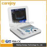 Ultrasonic, Optical, Electronic Equipments Laptop Portable B pc Based Ultrasound Scanner thumbnail-1