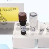 2019-Novel Coronavirus (2019-nCoV) RT-PCR Detection Kit   covid 19 rapid test kit wholesaler/distributor