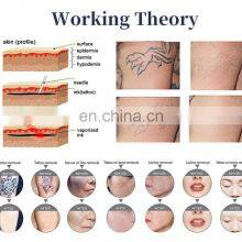 Latest Technology Equipment 808nm Laser Diode Price Tattoo Removal Machine for Beauty Salon thumbnail-5