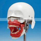 Conduction Anesthesia Model for Practice Extract and Anesthesia thumbnail-3