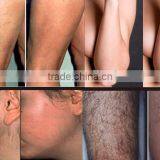 2016 Latest Best Portable Diode Laser Hair Removal 808/ Laser Hair Removal Body Care Machine/ Laser Hair Removal Candela thumbnail-6