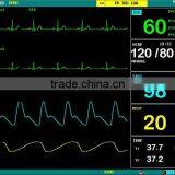 Jumper JPD 800B Vital Signs Veterinary Patient Monitor -clinic Animal Monitor thumbnail-2