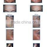YUWEI RF Radio Frequency Eye Body Face Lift Eye Care Massage thumbnail-6
