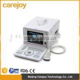 Factory Price!!CE Approved Notebook/Portable Ultrasound Scanner With 3.5Mhz Multi-frequency Convex Probe RUS-6000D thumbnail-1