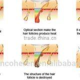 NYC (opt Technology ) Laser Hair Removal and Skin Rejuvenation Machine thumbnail-6