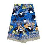 Bestway Guipure Lace Mix Wax With Stones BLW003 thumbnail-6