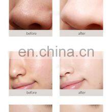 Pdt Led Light Therapy Facial Beauty Machine Microdermabrasion 6 In1 Hydro Water Oxygen Jet Peel Machine thumbnail-5