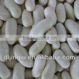 2015 Crop Kidney Bean thumbnail-4
