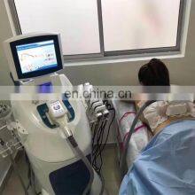 Appareil Cryolipoly / Cryolipolis Vacum Cryolipoly / Membran Cryolipoly Freezefat Meilleur Machine Cryolipolyse thumbnail-4