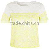 Wholesale Green Embroidery Lace Trim T Shirt Design thumbnail-1