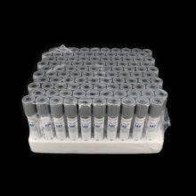 Glucose Blood Collection Tube Disposable Vacuum Plasma Blood Collection Tube for Blood Glucose Determination thumbnail-5