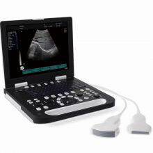 Notebook Ultrasound Scanner Detector for Human Pregnancy Checking thumbnail-3