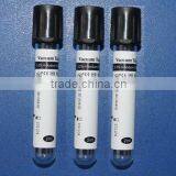 Vacuum Blood Tube---2ml ESR Tube