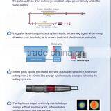 High Cost - Perormance Easy Work Long Time Continues CE Approved Q Switched Nd Yag Laser Vertical Laser Tattoo Removal Machine thumbnail-5