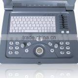 Promotion Price Cheapest 3D Laptop Color Doppler Ultrasound/doppler Ultrasound thumbnail-5