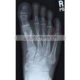 Good Quality Konida Automatic Medical X-ray Fuji Dry Film Agfa Holder Processor thumbnail-3