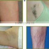 Higher Energy E-light Ipl Shr Hair Removal Laser Machine for Spa and Clinic thumbnail-5