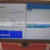 Beautiful Sperm Analysis System Analysis of Sperm Quality thumbnail-5