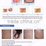 Promotion Acne Treatment Face Lift Skin Tightening Wrinkle Remover CO2 Laser Machine thumbnail-4