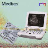 B Ultrasound Scanner thumbnail-1