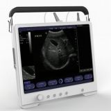 15'' Touch Screen High Resolution Portable Ultrasound Scanner Ultrasonic Diagnostic Device with Multi-frequency Probes