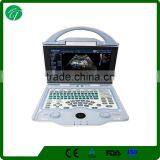 Cardiac Portable Ultrasound 3D 4D Ultrasound Scanner Color Doppler Ultrasound Machine Price thumbnail-1