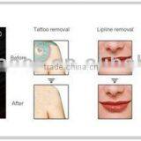 Q-switched Ndyag Laser,professional for Tattoo,pigment ,eyebrow Removal thumbnail-4