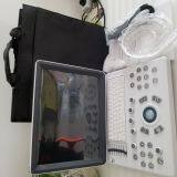 Ultraslim Notebook Type Black and White Ultrasound Scanner Machine Bw-8 thumbnail-4