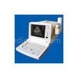 Portable Ultrasonic Diagnostic System / Ultrasound scanner 200A / 64 - Frame Cinema Loop