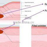 Portable Skin Renewal Micro Needle rf Co2 Fractional Laser for Sale thumbnail-6