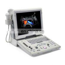 Popular Trolley Scanner Mindray / z6 Mindray /buy Ultrasound Scanner for Hospital thumbnail-1