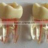 Tooth shaped items root canal model