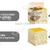 2015 OD-LS450 Multifunction Beauty Machine Tattoo Removal Portable nd Yag q Switch Mini Laser Nevus Removal Machine thumbnail-3